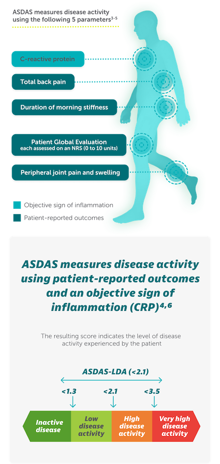 Rheuma-nr-axSpA-asas40-Disease-Activity-Mobile